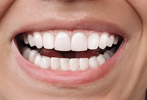 Dream Dental Group | Night Guards, Patital Dentures and Dental Bonding